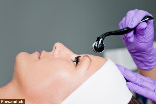 Bild 1: Microneedling Care bei PRIZ Beauty