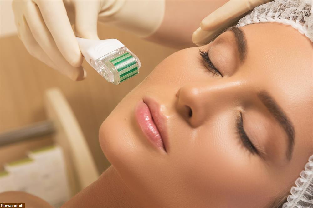 Bild 1: Microneedling Care | PRIZ Beauty